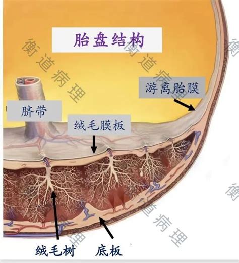 胎盘长什么样|【衡道丨笔记】胎盘体系课第一讲（上）：胎盘正常解。